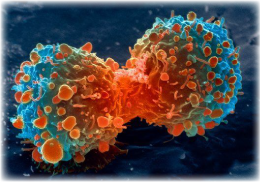 A cancer cell divides.